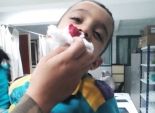 بالصور| مدير مستشفى المحلة ينقذ طفل بعد غياب طبيب الاستقبال