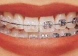  نقابة أطباء الأسنان بدمياط تحذر من التعامل مع مدعي المهنة 