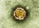  إيطاليا تعلن أول حالة إصابة بالفيروس التاجي الشبيه بـ